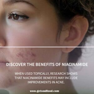 niacinamide serum benefit 2