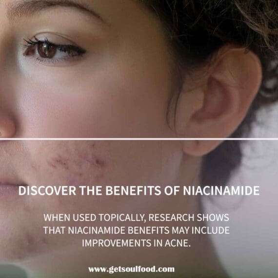 niacinamide serum benefit 2